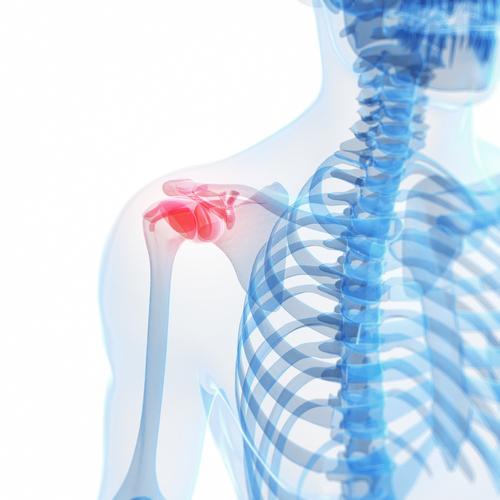 rotator-cuff-injuries-from-a-car-accident