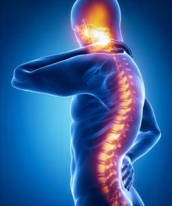 Do I have spinal cord compression from my car accident