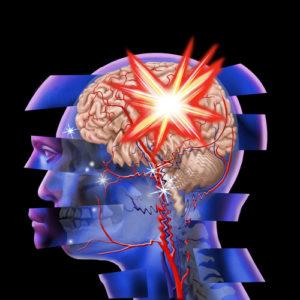 What are common emotional and psychological effects of traumatic brain injury