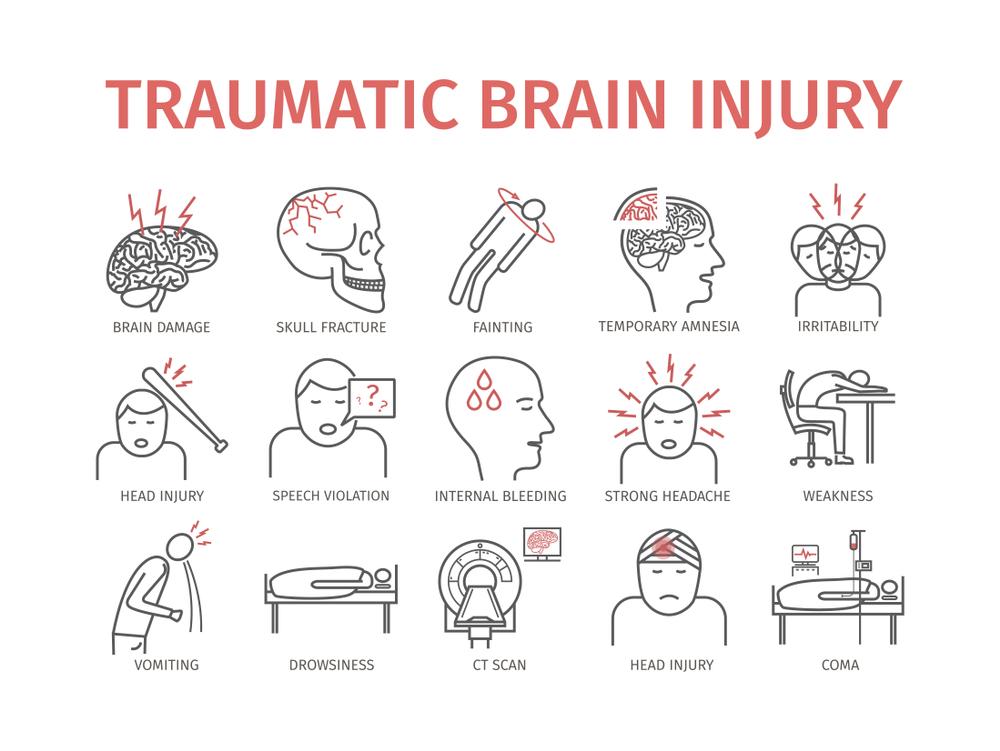 Injury head types of Head Injury:
