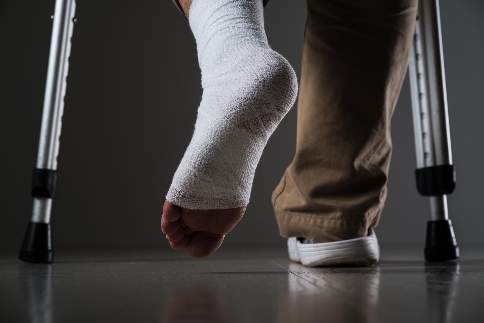 What are Common Foot Injuries from Auto Accidents? FAQ Bressman Law