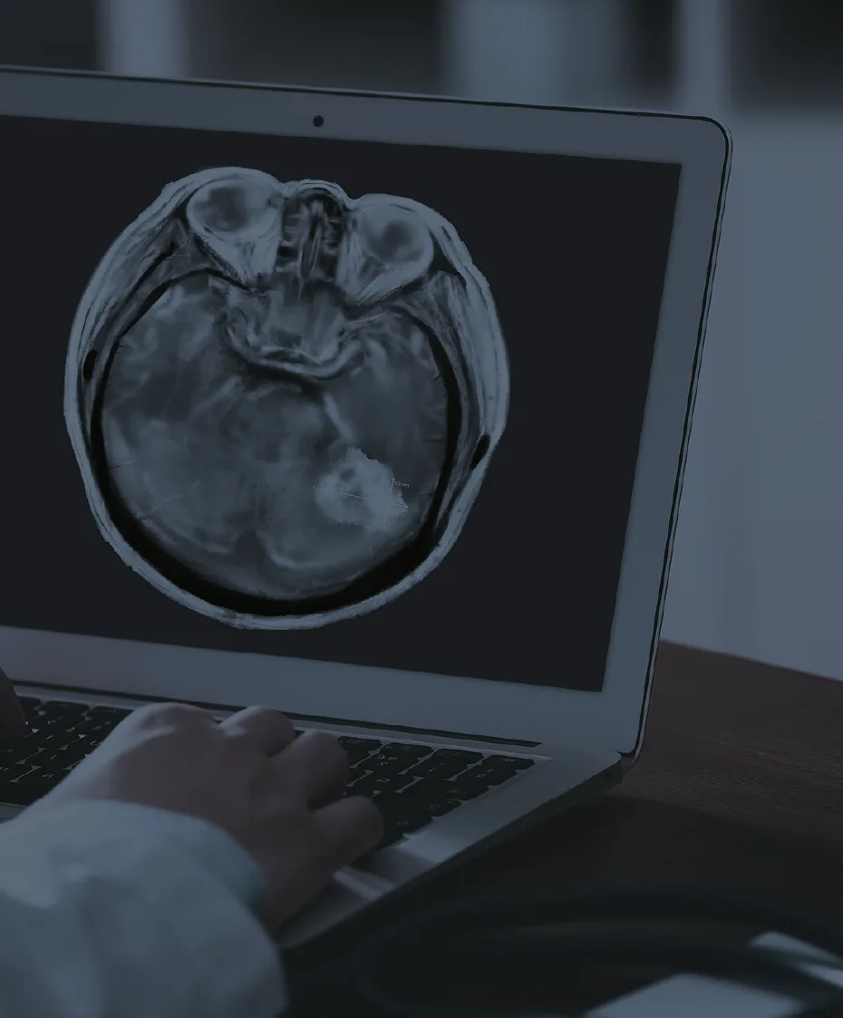traumatic-brain-injury-lawsuits brain injury